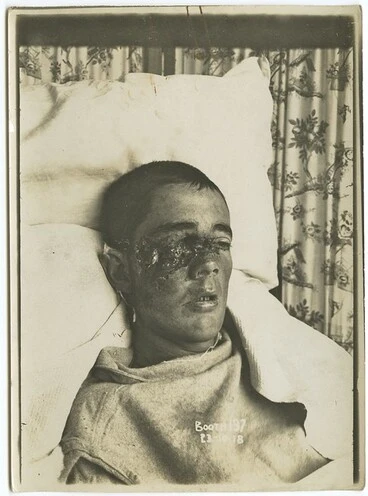 Image: Wounded Soldier