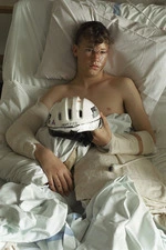 Shanan Harris in Wellington Hospital after a bicycle accident - Photograph taken by Phil Reid