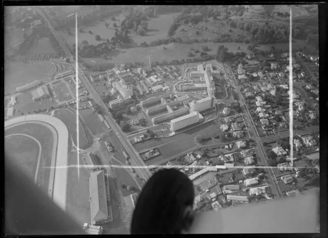 National Women's Hospital, Greenlane, Auckland