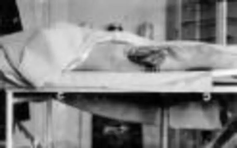 Image: Body with badly wounded thigh, Forest Park military hospital? a WW1 New Zealand military hospital in Brockenhurst, Hamphire, United Kingdom [picture] /