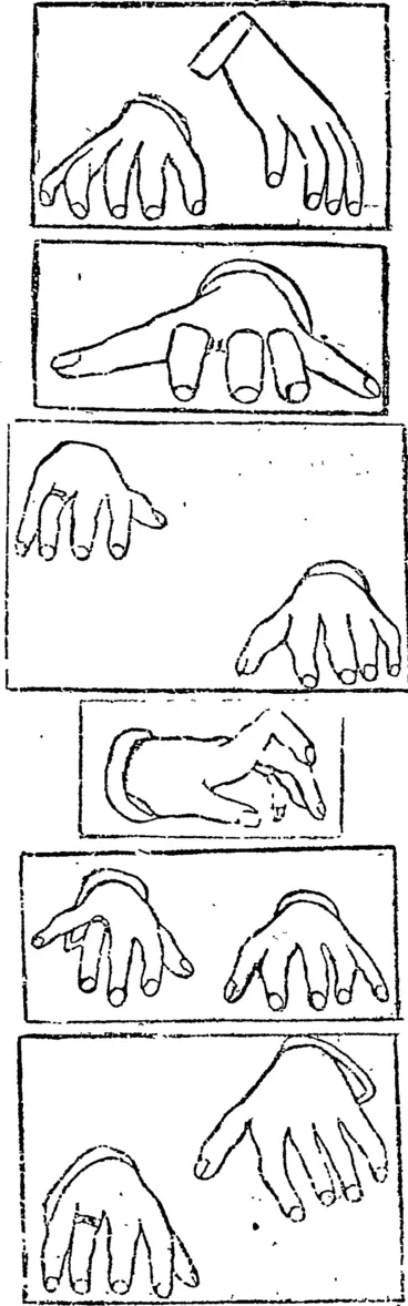 Image: The first two diagrams represent the bands of Tausig and Liszt respectively ; the third Padercweki's; the fourth and fifth I'ubinstein's (the single hand) and Pachmann's ; the sixth Eosenthal's., (Otago Witness, 14 December 1899)
