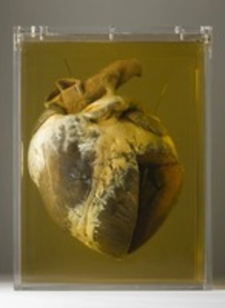 Image: Phar Lap's Heart