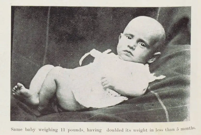 Image: Same baby weighing 11 pounds, having doubled its weight in less than 5 months