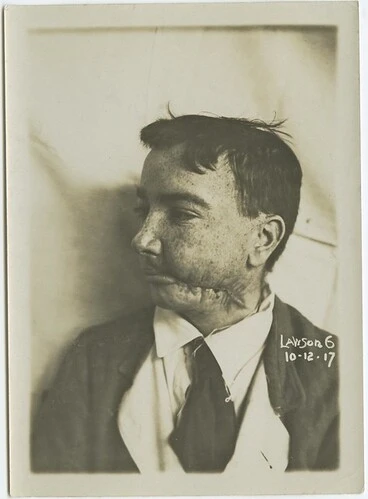 Image: Wounded soldier