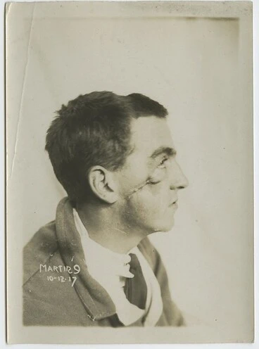 Wounded soldier Image: Wounded soldier