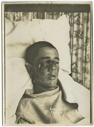 Wounded Soldier Image: Wounded Soldier