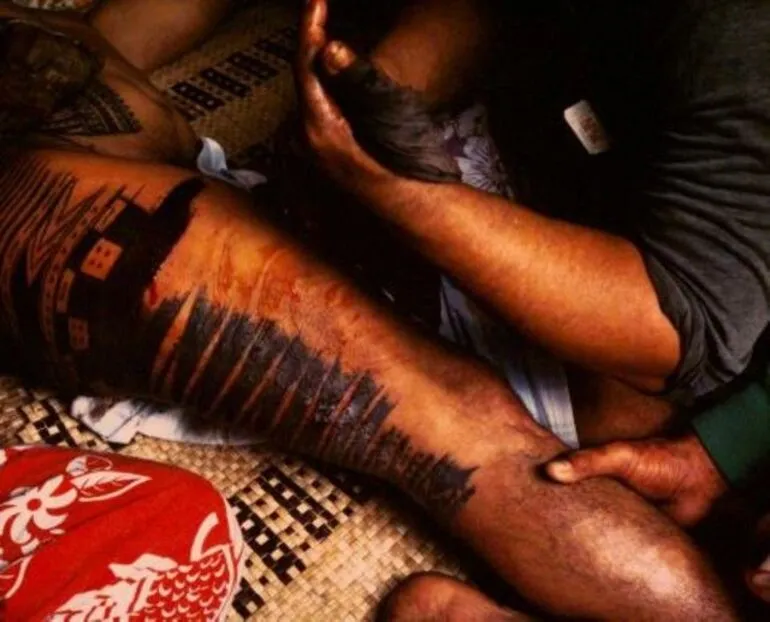 Image: 'Victim, Uli, right leg'