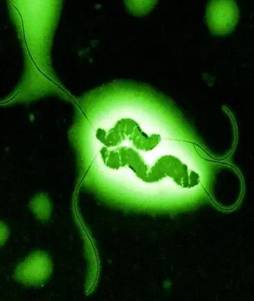 Campylobacter Image: Campylobacter