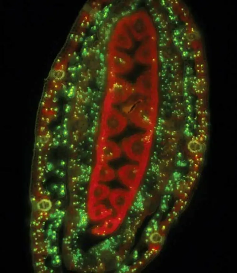 Image: Endophyte infection of ryegrass