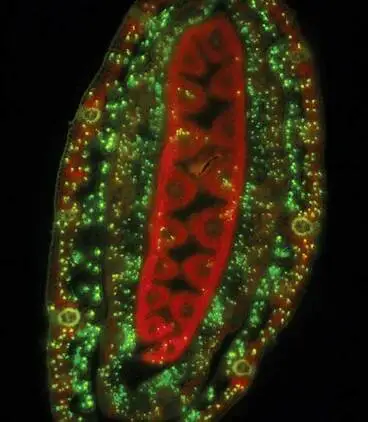 Endophyte infection of ryegrass Image: Endophyte infection of ryegrass