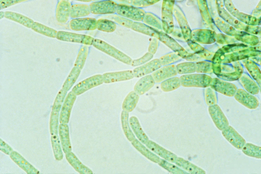 Blue-green alga isolated from geothermal soil on Mt Erebus: Mastigocladus laminosus (1000x magnification)