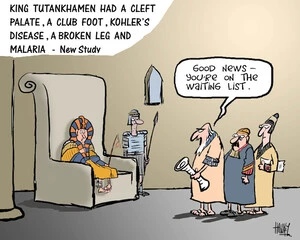 King Tutankhamen had a cleft palate, a club foot, Kohler's disease, a broken leg and malaria - New study. 18 February 2010