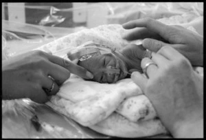 Premature baby, Neonatal Unit, Wellington Hospital, New Zealand