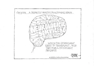 Oh look ... a perfectly healthy, functioning brain... which the government want to transplant... once they find a convenient prognosis. A solution looking for a problem. 11 August 2010