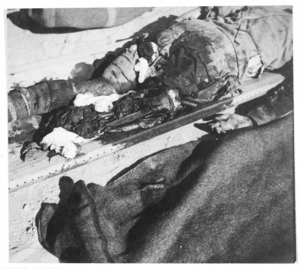 World War 2 soldier with one leg blown off by a bomb, El Alamein, Egypt - Photograph taken by K G Killoch
