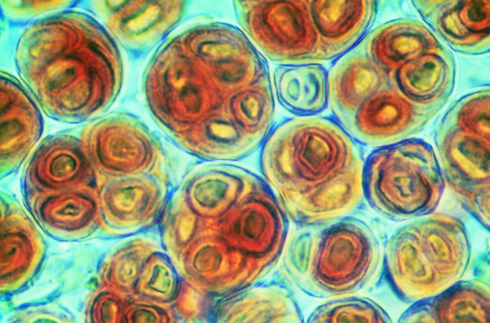 Blue-green algae: unicells embedded in mucilaginous colonies; mucilage pigmented and stratified surrounding each cell; 1000x magnification; from geothermal soil on Mt Melbourne