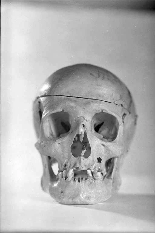 Showing the front view of a human skull
