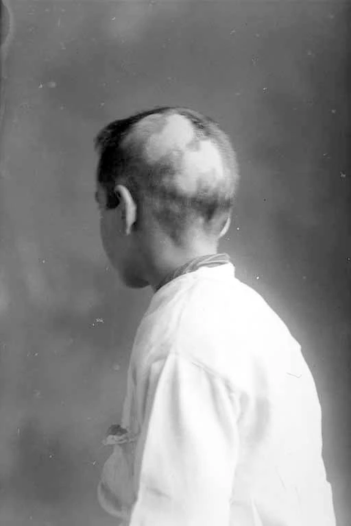 Showing the bald patches on the back of the head of Mr Mason's....