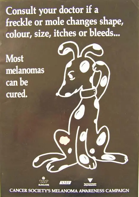 Most Melanomas Can Be Cured [poster]
