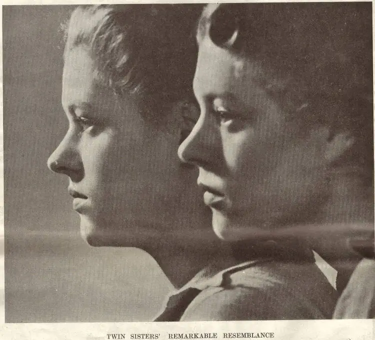 Twin sisters' remarkable resemblance