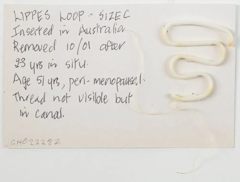 Lippes Loop intrauterine device (IUD)
