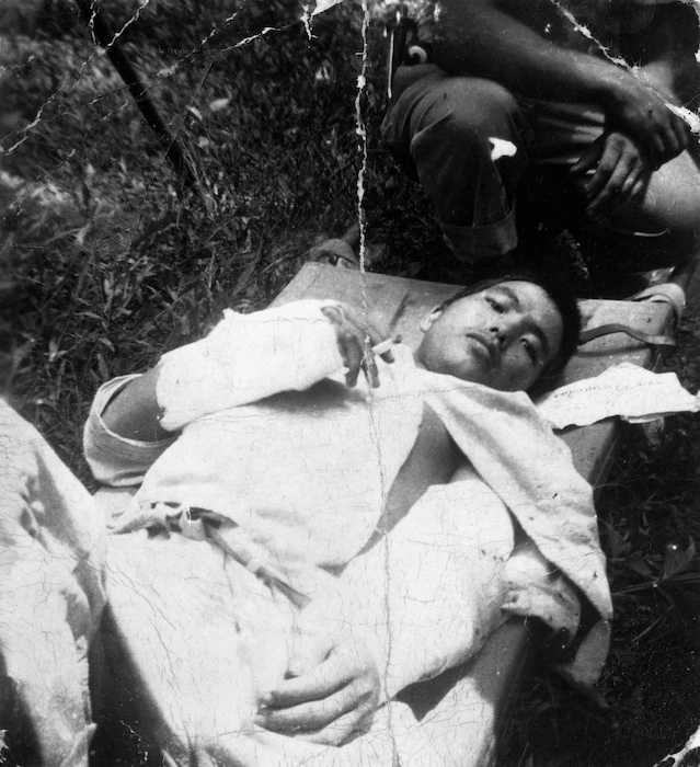 Wounded Japanese prisoner at Guadacanal, during World War II