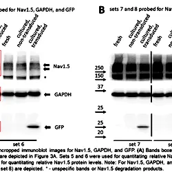 Image_1_Three-Week-Old Rabbit Ventricular Cardiomyocytes as a Novel System to Study Cardiac Excitation and EC Coupling.TIF