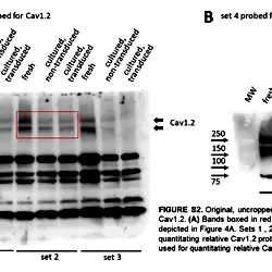 Image_2_Three-Week-Old Rabbit Ventricular Cardiomyocytes as a Novel System to Study Cardiac Excitation and EC Coupling.TIF