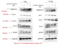 Image1_Effect of Amniotic Membrane/Collagen-Based Scaffolds on the Chondrogenic Differentiation of Adipose-Derived Stem Cells and Cartilage Repair.pdf