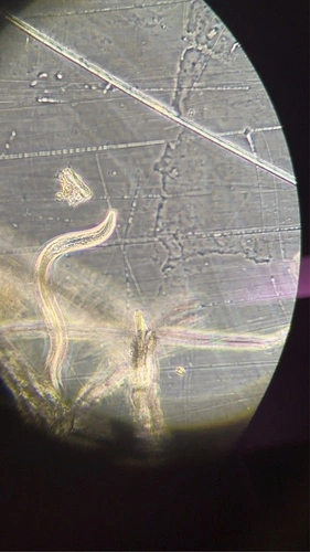 Eel-worms and Root-knot-worms